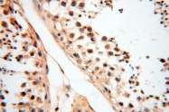13816-1-AP - Dixin