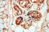 13816-1-AP - Dixin