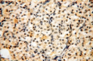 13816-1-AP - Dixin