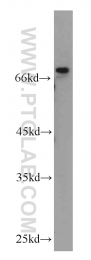 21584-1-AP - Delta-like protein 4 / DLL4