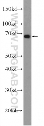 24356-1-AP - DMRTA1 / DMO