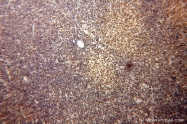 13174-1-AP - DNAJB1 / HSP40