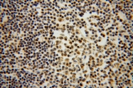 13174-1-AP - DNAJB1 / HSP40