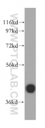15484-1-AP - DNAJB11