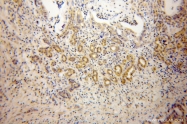13064-1-AP - DNAJB4 / HSP40 homolog