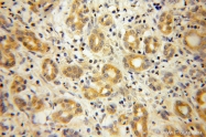 13064-1-AP - DNAJB4 / HSP40 homolog