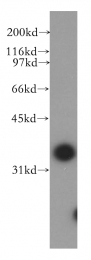 13064-1-AP - DNAJB4 / HSP40 homolog