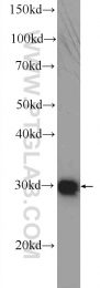 25444-1-AP - DNAJC9