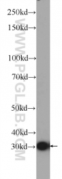 25444-1-AP - DNAJC9