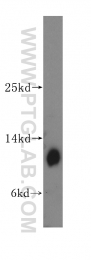 10388-1-AP - DNAL4