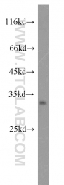15934-1-AP - Deoxyribonuclease-2-alpha