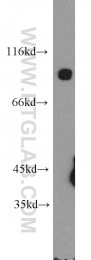 14737-1-AP - Dynamin-3