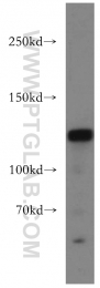 20954-1-AP - DNMT3A