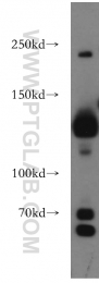 20954-1-AP - DNMT3A