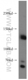 20954-1-AP - DNMT3A