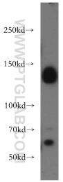 20954-1-AP - DNMT3A