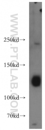 20954-1-AP - DNMT3A