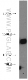 20954-1-AP - DNMT3A