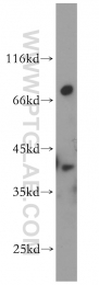 14108-1-AP - DOK6 / DOK5L
