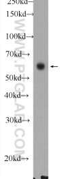 11568-1-AP - DPP9 / DPRP2