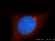 14521-1-AP - DPYSL2 / CRMP2