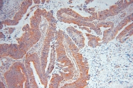 14521-1-AP - DPYSL2 / CRMP2