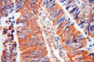 14521-1-AP - DPYSL2 / CRMP2