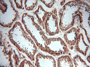 14686-1-AP - DPYSL2 / CRMP2