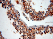 14686-1-AP - DPYSL2 / CRMP2