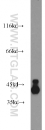 14743-1-AP - DRG2
