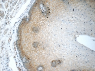 13876-1-AP - Desmocollin-2