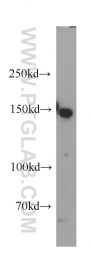 21880-1-AP - Desmoglein-2