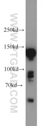 21880-1-AP - Desmoglein-2