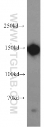 21880-1-AP - Desmoglein-2