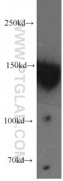 21880-1-AP - Desmoglein-2