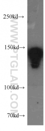 21880-1-AP - Desmoglein-2