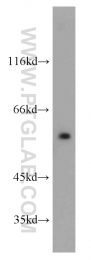 10741-1-AP - DTNA / DRP3