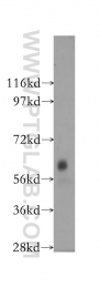 12045-1-AP - DTNB