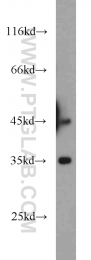 11132-1-AP - Dysbindin