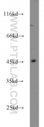 11132-1-AP - Dysbindin