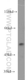 17253-1-AP - DUS1L