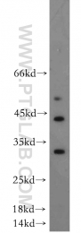 14629-1-AP - DUSP15