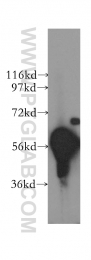 12240-1-AP - DYRK1B