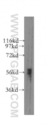 12240-1-AP - DYRK1B