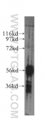 12240-1-AP - DYRK1B