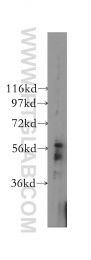 12240-1-AP - DYRK1B