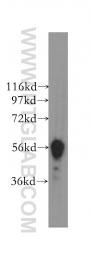 12240-1-AP - DYRK1B