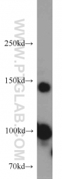 55001-1-AP - RNASEN