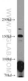 55001-1-AP - RNASEN