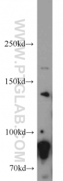 55001-1-AP - RNASEN